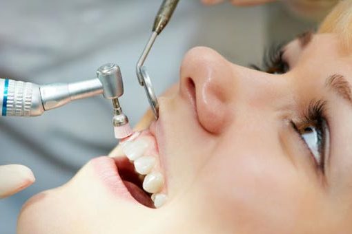 Root Canal Treatment