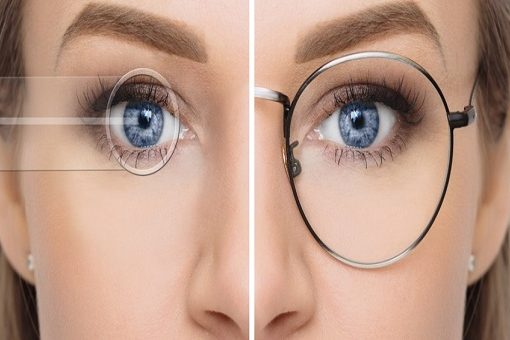 5 Reasons Why Lasik Eye Surgery May Not Be Suitable For You