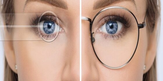 lasik-rightrail 5 Reasons Why Lasik Eye Surgery May Not Be Suitable For You
